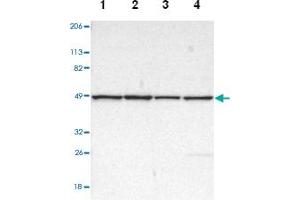 Western blot analysis of Lane 1: Human cell line RT-4, Lane 2: Human cell line U-251MG sp, Lane 3: Human cell line A-431, Lane 4: Human liver tissue with DLST polyclonal antibody .