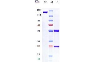 Anti-IFNAR1 Reference Antibody (anifrolumab) on SDS-PAGE under reducing (R) condition. (Recombinant IFNAR1 (Anifrolumab Biosimilar) 抗体)