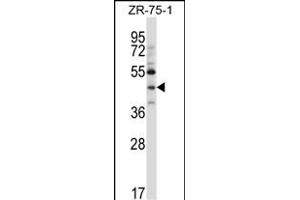 NEUROD6 Antibody (N-term ) (ABIN657404 and ABIN2846444) western blot analysis in ZR-75-1 cell line lysates (35 μg/lane). (NEUROD6 抗体  (N-Term))