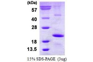 Image no. 1 for Heat Shock Protein, alpha-Crystallin-Related, B9 (HSPB9) (AA 1-159) protein (His tag) (ABIN1098602)