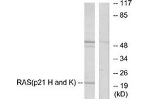 Western blot analysis of extracts from HeLa cells, using RASH/RASK Antibody. (RASH/RASK (AA 1-50) 抗体)
