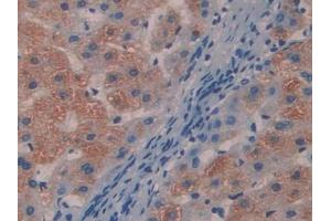 DAB staining on IHC-P; Samples: Human Liver Tissue (MYL9 抗体  (AA 5-163))
