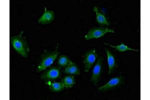 Immunofluorescent analysis of A549 cells using ABIN7149934 at dilution of 1:100 and Alexa Fluor 488-congugated AffiniPure Goat Anti-Rabbit IgG(H+L) (DPYSL4 抗体  (AA 280-560))