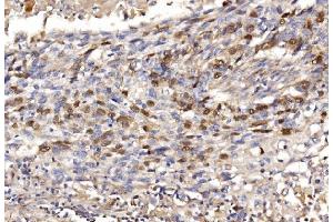 IHC analysis of Geminin/GMNN using anti-Geminin/GMNN antibody (ABIN7600598). (Geminin 抗体  (AA 21-196))