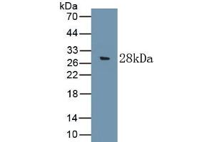 Detection of Recombinant C9, Rat using Polyclonal Antibody to Complement Component 9 (C9) (C9 抗体  (AA 336-554))