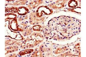 Immunohistochemistry (IHC) image for anti-Adenosine A2b Receptor (ADORA2B) (AA 292-332) antibody (ABIN7143307)