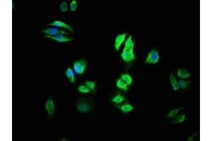 Immunofluorescence (IF) image for anti-URI1, Prefoldin-Like Chaperone (URI1) (AA 180-298) antibody (ABIN7174989)