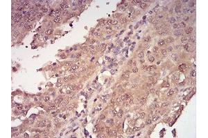 Immunohistochemistry (IHC) image for anti-14-3-3 alpha + beta (YWHAB) (AA 1-246) antibody (ABIN5542549)