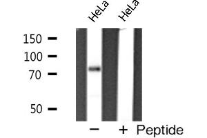 Western blot analysis of FOXP2 expression in HeLa cells (FOXP2 抗体)