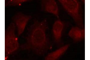 Immunofluorescence staining of methanol-fixed Hela cells using Merlin(Phospho-Ser518) Antibody.
