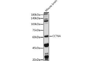 Western blot analysis of extracts of Mouse brain, using CCT6A antibody (ABIN1679063, ABIN3017847, ABIN3017849 and ABIN6220290) at 1:1000 dilution. (CCT6A 抗体  (AA 80-250))