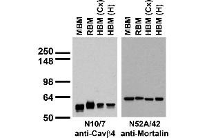 Immunoblots on brain membranes prepared from whole rat (RBM) and mouse (MBM) brain, and from human cerebral cortex [HBM(Cx)] and hippocampus [HBM(H)].