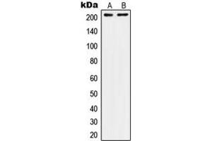 Western blot analysis of CD104 expression in A431 (A), SW480 (B) whole cell lysates. (Integrin beta 4 抗体  (C-Term))