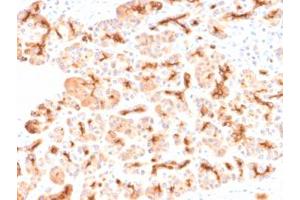 IHC testing of FFPE human pancreas with recombinant CFTR antibody (clone CFTR/2290R). (CFTR / Cystic Fibrosis Transmembrane Regulator 抗体)