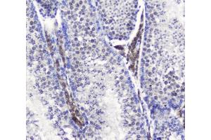 IHC analysis of SMC6L1 using anti-SMC6L1 antibody (ABIN5693133). (SMC6 抗体  (AA 205-443))
