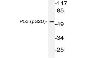 Western blot (WB) analysis of p-P53 antibody in extracts from COS7 cells. (p53 抗体  (pSer20))