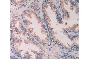Used in DAB staining on fromalin fixed paraffin- embedded Kidney tissue (SCUBE3 抗体  (AA 807-993))
