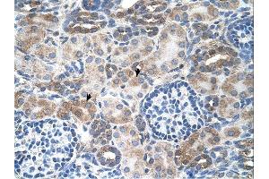 SLC14A1 antibody was used for immunohistochemistry at a concentration of 4-8 ug/ml. (SLC14A1 抗体  (C-Term))