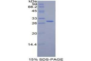SDS-PAGE analysis of Mouse Jagged 2 Protein. (JAG2 蛋白)