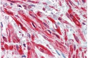 Human Prostate, stroma: Formalin-Fixed, Paraffin-Embedded (FFPE) (TRIM5 抗体)