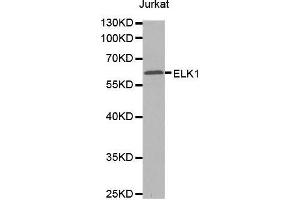 Western blot analysis of extracts of Jurkat cells tissue, using ELK1 antibody. (ELK1 抗体  (AA 90-250))