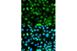 Immunofluorescence analysis of HeLa cells using ATXN3 antibody. (Ataxin 3 抗体  (AA 1-364))