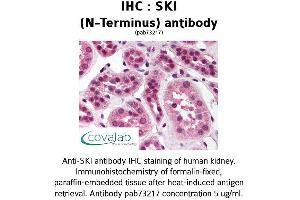 Image no. 2 for anti-SKI Proto-Oncogene (SKI) antibody (ABIN1739312) (SKI 抗体)