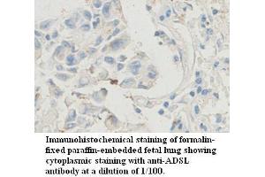 Image no. 1 for anti-Adenylosuccinate Lyase (ADSL) antibody (ABIN1574515) (Adenylosuccinate Lyase 抗体)