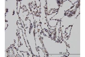 Immunoperoxidase of monoclonal antibody to DLX2 on formalin-fixed paraffin-embedded human lung. (DLX2 抗体  (AA 1-110))