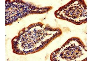 Immunohistochemistry of paraffin-embedded human small intestine tissue using ABIN7147620 at dilution of 1:100 (Choline Acetyltransferase 抗体  (AA 354-592))