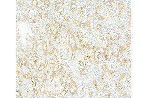 Immunohistochemistry (IHC) image for anti-CD36 (CD36) (AA 30-439) antibody (ABIN7449417) (Recombinant CD36 抗体  (AA 30-439))