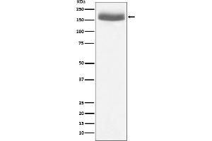 Western blot analysis of EGF expression in human urine sample lysate.