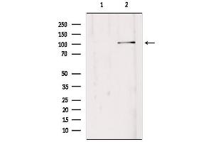 Western blot analysis of extracts from Hepg2, using EDEM3 Antibody.