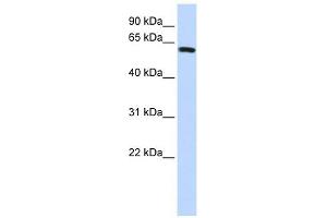 SPAG8 antibody used at 1 ug/ml to detect target protein. (SPAG8 抗体  (Middle Region))