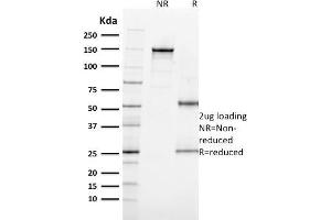 SDS-PAGE Analysis Purified MITF Mouse Monoclonal Antibody (MITF/915). (MITF 抗体)