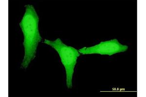 Immunofluorescence of monoclonal antibody to ZEB1 on HeLa cell. (ZEB1 抗体  (AA 801-900))