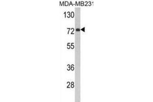 Western Blotting (WB) image for anti-Flavin Containing Monooxygenase 3 (FMO3) antibody (ABIN3002867) (FMO3 抗体)