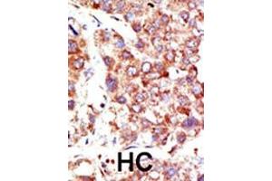 Immunohistochemistry (Paraffin-embedded Sections) (IHC (p)) image for anti-Neural Precursor Cell Expressed, Developmentally Down-Regulated 8 (NEDD8) (AA 1-32), (N-Term) antibody (ABIN388037)