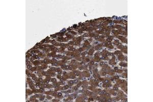 Immunohistochemical staining of human liver with PYGL polyclonal antibody  shows strong cytoplasmic positivity in hepatocytes at 1:500-1:1000 dilution.