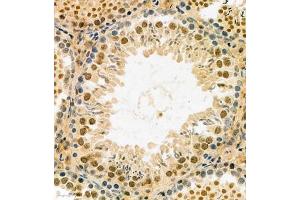 Immunohistochemistry analysis of paraffin embedded rat testis using MASTL (ABIN7074616) at dilution of 1: 2100 (MASTL 抗体)