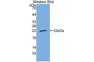Western Blotting (WB) image for anti-Cell Division Cycle 25 (CDC25) (AA 376-524) antibody (ABIN1867137) (Cdc25 抗体  (AA 376-524))