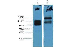 Western Blotting (WB) image for anti-Keratin 8 (KRT8) antibody (ABIN3178608) (KRT8 抗体)