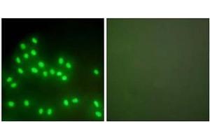 Immunofluorescence analysis of A549 cells, using Ku70/80 Antibody . (XRCC5 抗体  (C-Term))