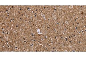 Immunohistochemistry of paraffin-embedded Human brain tissue using CMTM5 Polyclonal Antibody at dilution 1:40 (CMTM5 抗体)