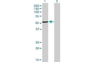Western Blot analysis of MAK expression in transfected 293T cell line by MAK monoclonal antibody (M02), clone 4E9. (MAK 抗体  (AA 358-457))