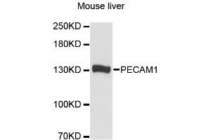 Western blot analysis of extracts of mouse liver, using PECAM1 antibody. (CD31 抗体)