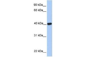 MGC29891 antibody used at 0. (GABPB2 抗体  (C-Term))
