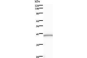 Western Blotting (WB) image for anti-SRY (Sex Determining Region Y)-Box 6 (SOX6) antibody (ABIN931254) (SOX6 抗体)