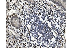 IHC analysis of SAMHD1 using anti-SAMHD1 antibody (ABIN7601516).