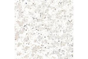 Immunohistochemistry of paraffin-embedded rat fetal liver using Survivin Rabbit pAb (ABIN6132229, ABIN6137562, ABIN6137563 and ABIN6218613) at dilution of 1:100 (40x lens).